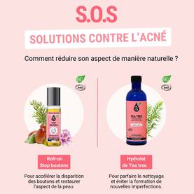 L’acné se manifeste par des lésions cutanées sur le visage, le haut du dos et le torse ainsi qu’une peau grasse. S’il disparait souvent autour de 20 ans, les cicatrices sur la peau et l’impact psychologique qu’il induit ne sont pas négligeables.À savoir : Le premier réflexe à acquérir est celui de l’hygiène ! Nos deux solutions naturelles : 🌿 Localement, appliquez le roll-on stop-bouton LCA pour accélérer la disparition des boutons et restaurer l’aspect de la peau. 🌿 L’hydrolat de tea-tree : Après avoir bien nettoyé le visage, versez l’hydrolat de tea-tree LCA sur un coton et appliquez-le sur l’ensemble du visage, matin et soir, en insistant sur la zone T. C’est l’astuce à bien connaitre pour parfaire le nettoyage et éviter la formation de nouvelles imperfections ! Seulement 40 % des patients concernés ont une hygiène du visage suffisante.💡 Astuce : Utilisez-le aussi dans notre diffuseur Nérolia en brumisateur sur l’ensemble du visage, comme un spray d’eau thermale. Nos conseils : 👉 Ne jamais gratter ou percer un bouton d’acné afin d’éviter les cicatrices définitives 👉 Utilisez un savon spécifique des peaux mixtes à grasses 👉 Hydratez la peau à l’aide d’une crème adaptée ou d’huile végétale de jojoba pour réguler la sécrétion de sébum. Evitez les cosmétiques gras dits « comédogènes » 👉 Protégez-vous toujours du soleil 👉 Veillez à favoriser l’apport de fruits, de légumes et d’acides gras essentiels (poissons) #Aromathérapie #huileessentielle #huilesessentielles #aromatherapy #essentialoil #essentialoils #Provence #Valensole #Plateaudevalsensole #Alpesdehauteprovence #qualite #acné #acne #sosboutons #teatree #arbreathe #geranium #palmarosa #lavande #pharmacie